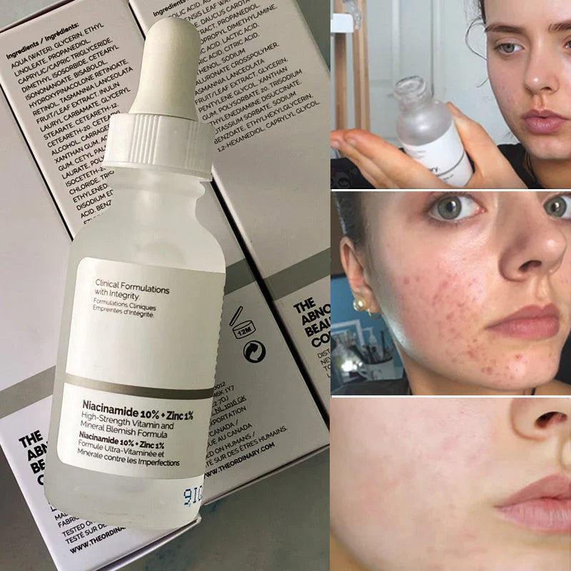 Kit The Ordinary Ácido Hialuronico + Niacinamida